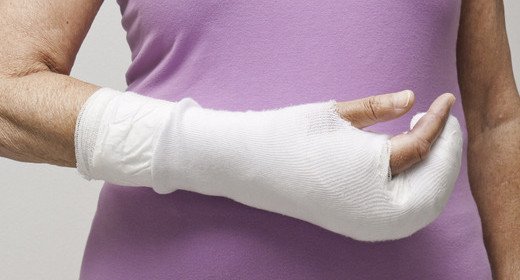 Наложение гипса при переломе пальца руки