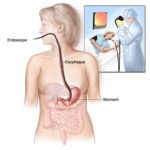 Эндоскопическое исследование кишечника и желудка