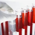 Лабораторные анализы крови