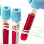 Лабораторный анализ крови