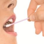 Мазок слизистой оболочки рта