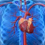 Тяжелые заболевания сердечно-сосудистой системы
