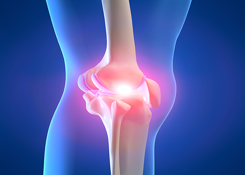 Лечение артроза колена